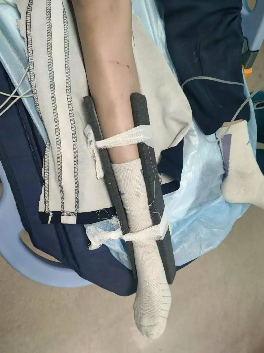 惨痛<strong></p>
<p>宏达币</strong>！一人身亡！深圳多名学生骑电动车发生意外