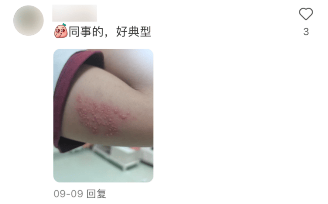 一旦感染终身携带<strong></p>
<p>屋里币</strong>！深圳疾控提醒：这4类人要注意