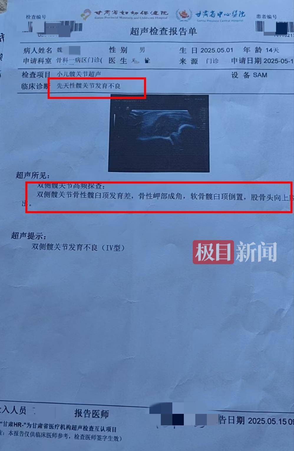 二胎出生查出先天性病症或落下残疾<strong></p>
<p>牛币商城</strong>，残疾父母称医院产检漏检、未尽告知义务，医院及医调委回应