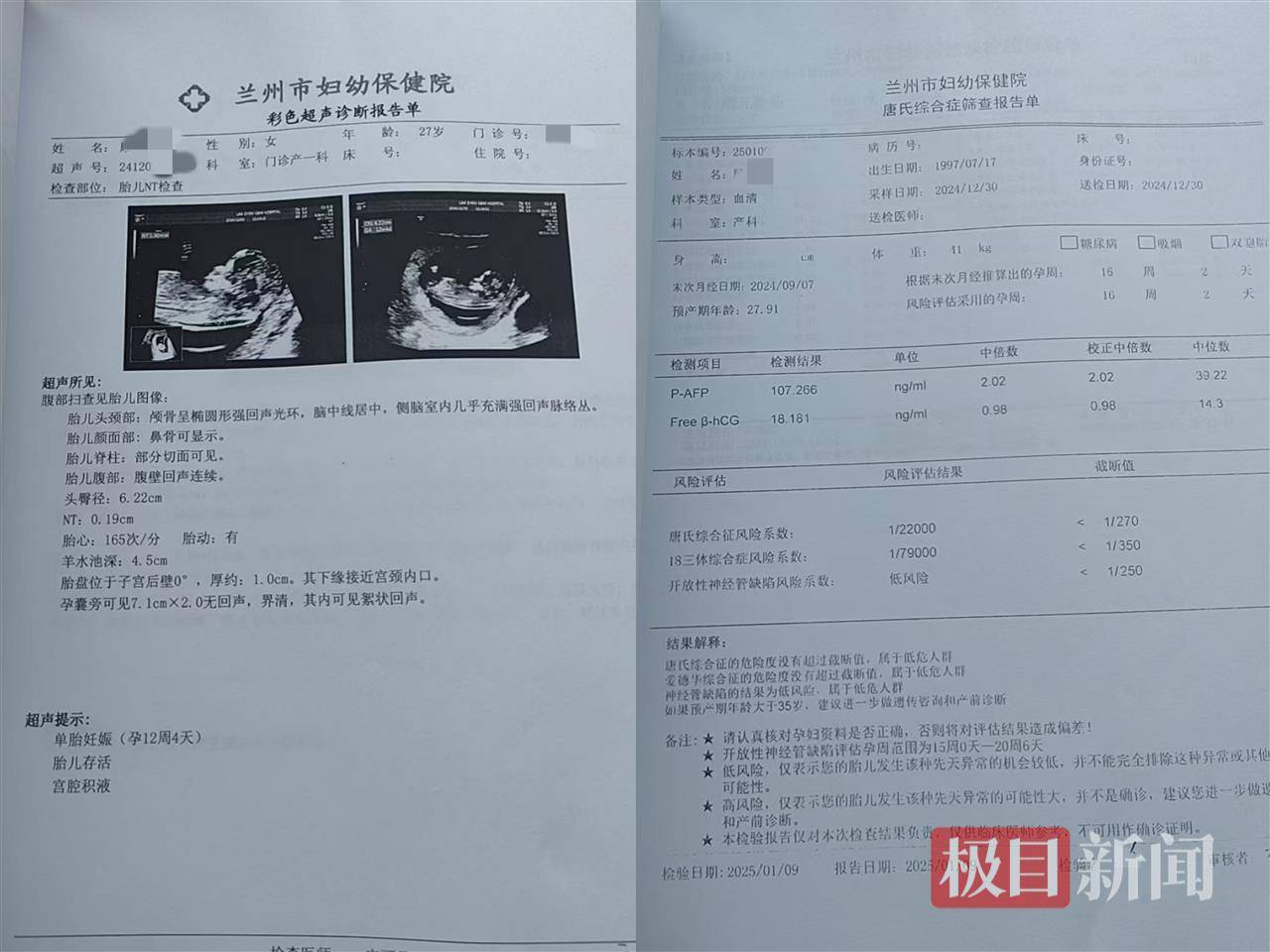 二胎出生查出先天性病症或落下残疾<strong></p>
<p>牛币商城</strong>，残疾父母称医院产检漏检、未尽告知义务，医院及医调委回应