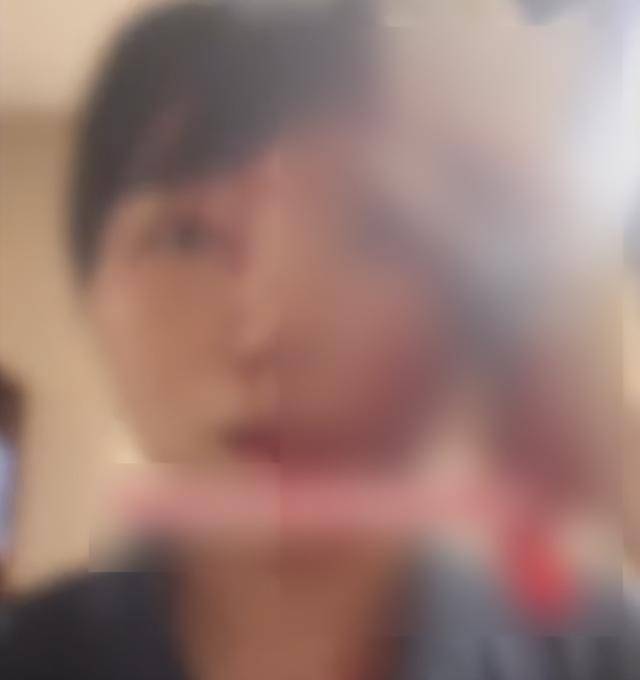 缝了20多针！女子称被不知名男同事砸头毁容<strong></p>
<p>维特币</strong>，警方介入