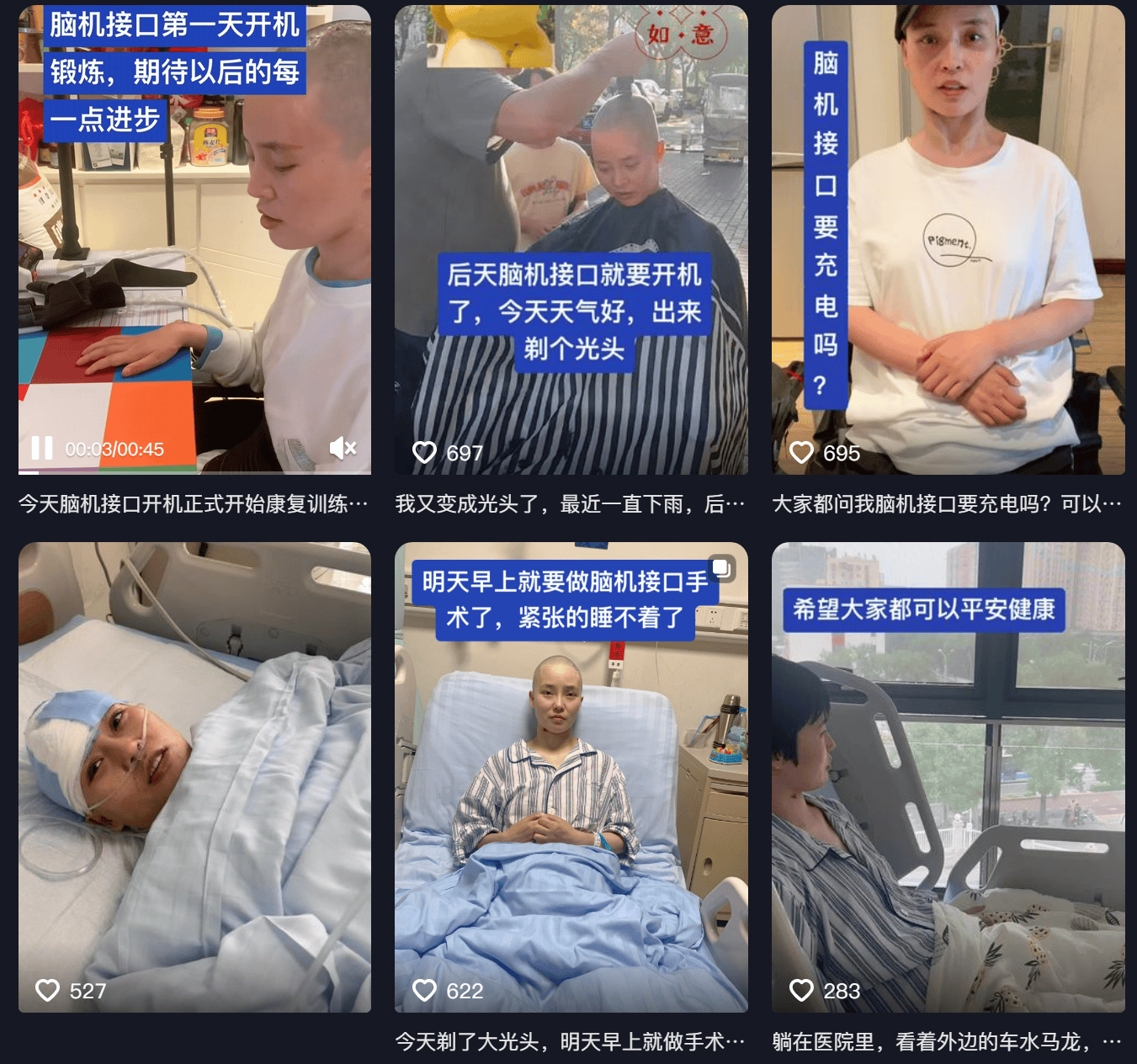 女子因车祸全身瘫痪6年仅嘴眼能动<strong></p>
<p>币久</strong>，接受脑机接口手术后通过意念抓取物品！当事人讲述