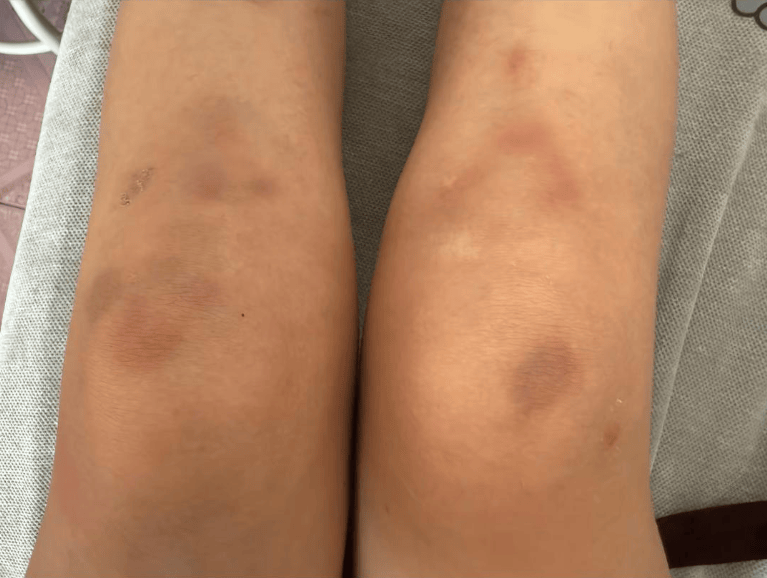 女子自称因工资问题被老板锁办公室里打 警方：双方已到派出所<strong></p>
<p>币小白</strong>，是否打人还在调查