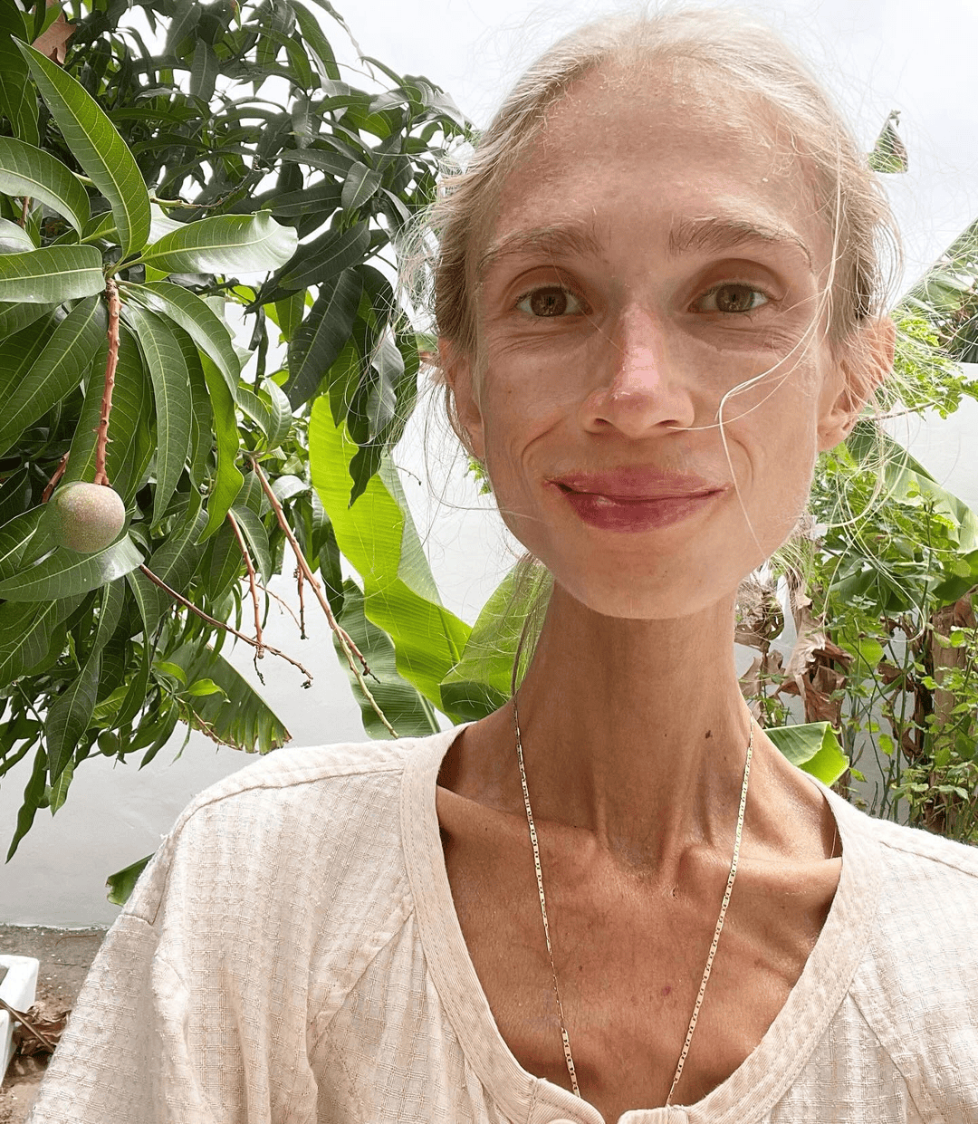 坚持只吃水果8年<strong></p>
<p>牛币币</strong>,27岁波兰女子巴厘岛酒店去世:体重仅22公斤,指甲变黄牙齿腐烂