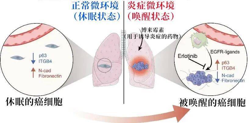 长期炎症会“唤醒”癌细胞<strong></p>
<p>牛币币</strong>！这份抗炎指南每个人都该看看