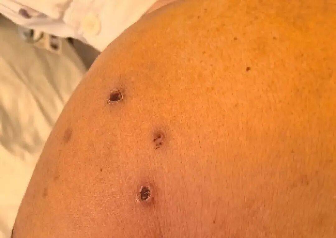 深圳一市民突遭马蜂围袭！已进入高发期<strong></p>
<p>火特币</strong>，千万别招惹！