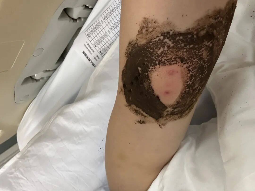 4名游客景区内遭马蜂袭击<strong></p>
<p>火特币</strong>,旅游度假区:是森林公园不卖门票,蜇伤先就医后提供证据投诉