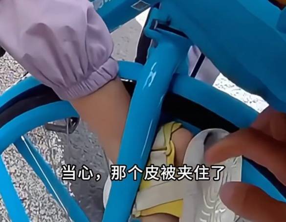 看着都疼<strong></p>
<p>黑币2001</strong>!上海街头一男子突然求助:10岁女儿被死死卡住!这个行为太危险→