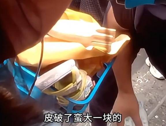看着都疼<strong></p>
<p>黑币2001</strong>!上海街头一男子突然求助:10岁女儿被死死卡住!这个行为太危险→