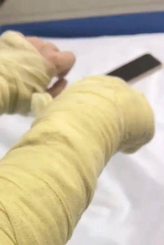 湖南一女主播被伪装的包裹炸伤<strong></p>
<p>黑币2001</strong>，永州公安：正在核实具体情况