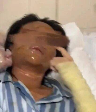 湖南一女主播被伪装的包裹炸伤<strong></p>
<p>黑币2001</strong>，永州公安：正在核实具体情况