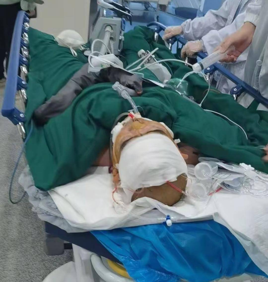 湖北十堰三名工人聚餐中毒<strong></p>
<p>37币</strong>，家属：食堂误把工业酒精当散酒